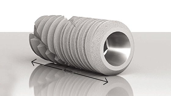 mini implant dentaire