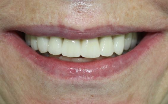 J'ai Guéri D'une Parodontite Naturellement Forum Parodontite : les causes et les traitements possibles