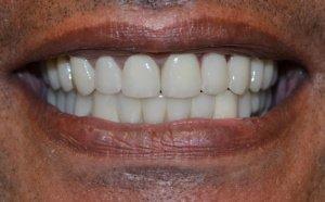 sourire abdelamid après