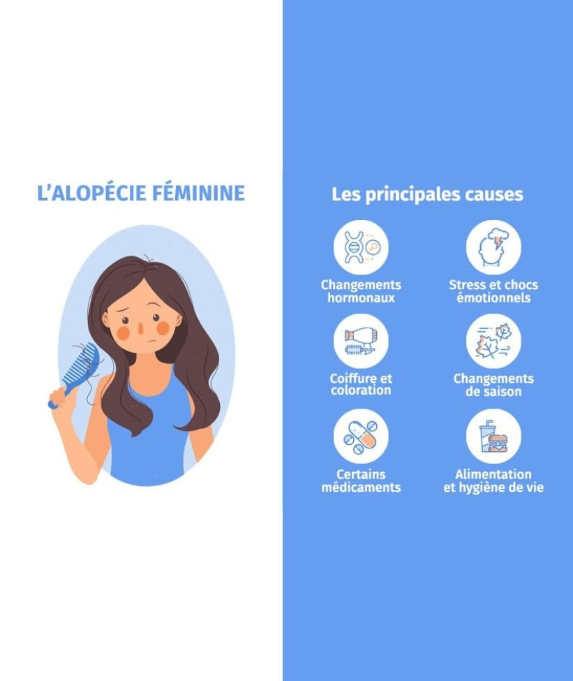 alopécie féminine