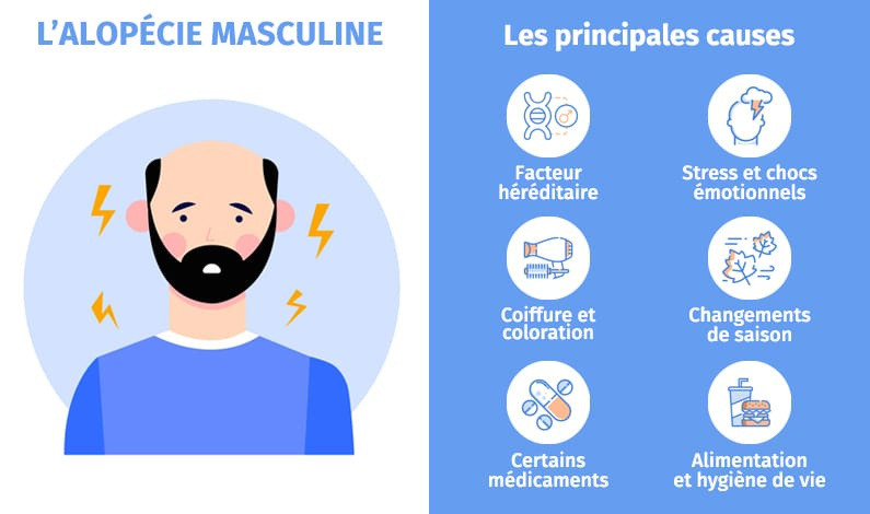 alopecie masculine