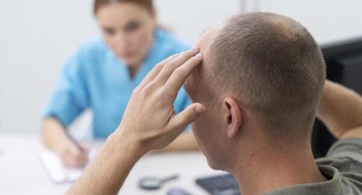 homme avec une perte de cheveux et son médecin