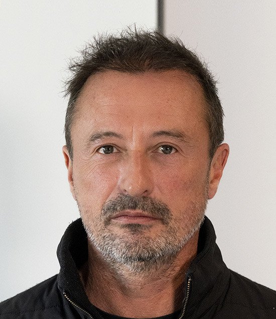 greffe de cheveux nicolas après