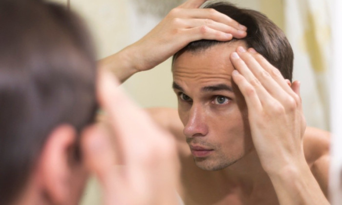 homme apres une greffe