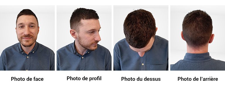 photos appel conseil capillaire