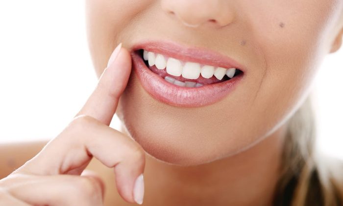 sourire de femme après un blanchiment dentaire