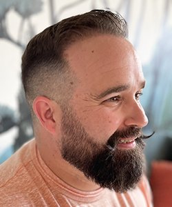 greffe de cheveux david après 12 mois