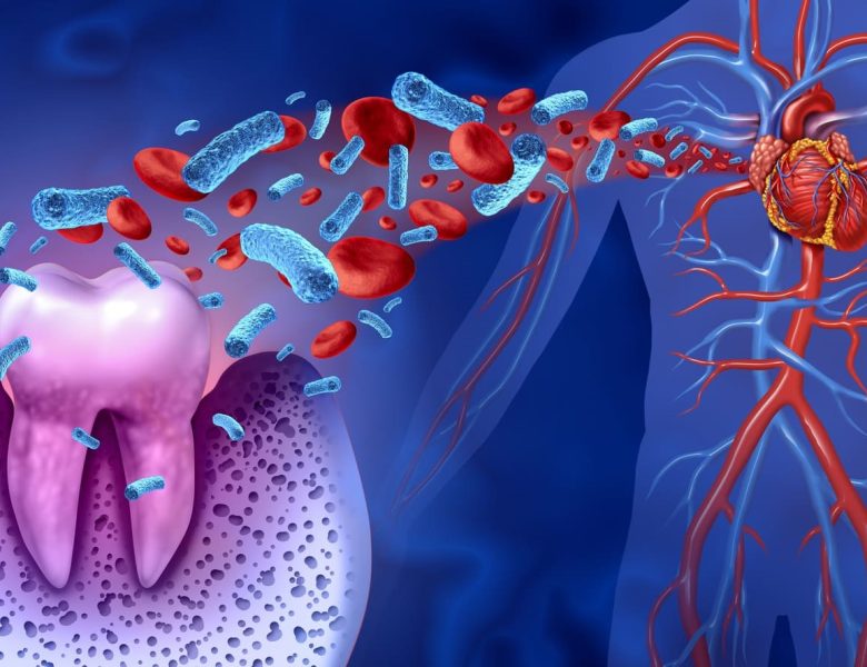 Illustration 3D montrant des bactéries circulant du site d'une dent vers le cœur à travers le système sanguin, mettant en évidence la connexion entre la santé dentaire et les maladies cardiovasculaires.