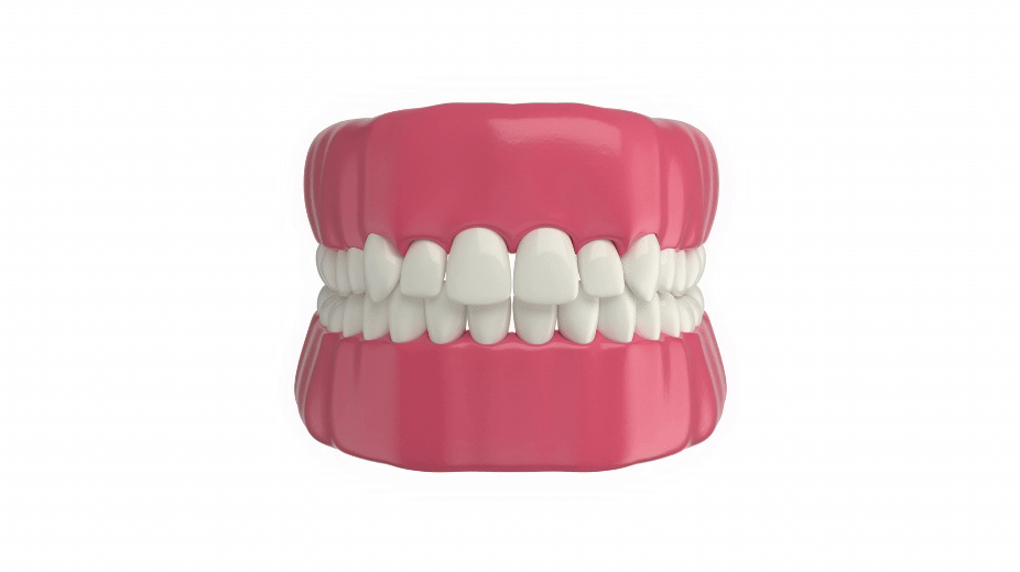 Modèle 3D d'une gouttière occlusale transparente ajustée sur une mâchoire avec des dents blanches et des gencives roses.
