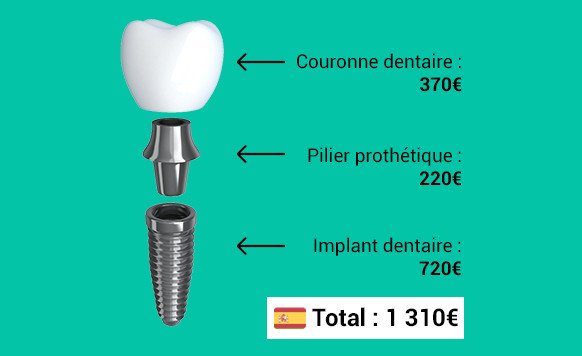 prix implant dentaire espagne
