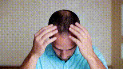 Un homme applique du Minoxidil sur son cuir chevelu, montrant l'application d'un traitement contre la calvitie.