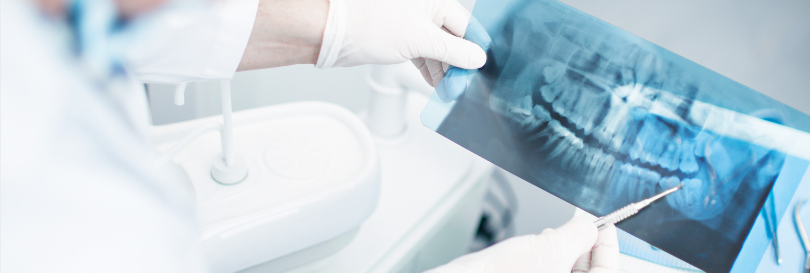 parodontite differences et detection