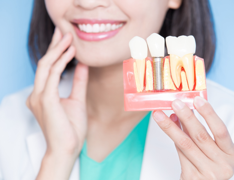 femme qui montre le remplacement des dents avec parodontite (via implant dentaire)