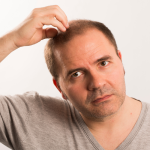 chute cheveux homme