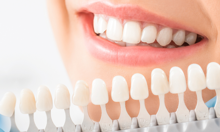 sourire d'une femme devant les teintes de dents pour couronne