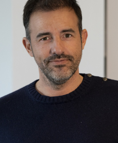 Cedric 1 an après sa greffe de cheveux