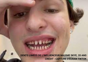 jeune homme influenceur tiktok avec dents limées