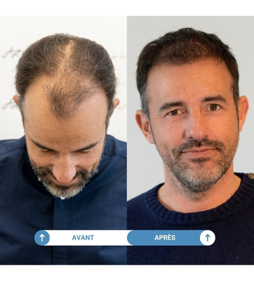 étude de cas cédric
