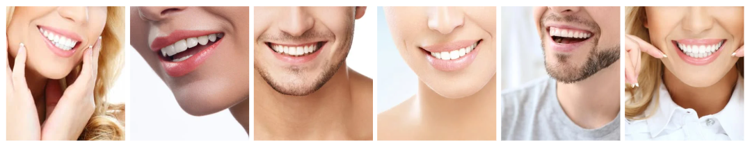 hollywood-smile-sourire-parfait