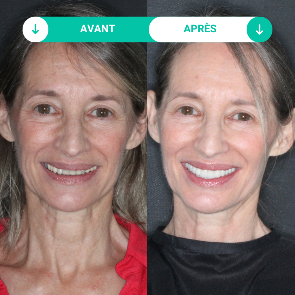 patiente soins dentaires