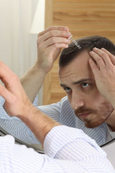 traitement cheveux minoxidil 5