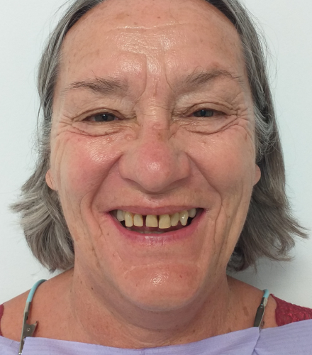 sourire Marie avant