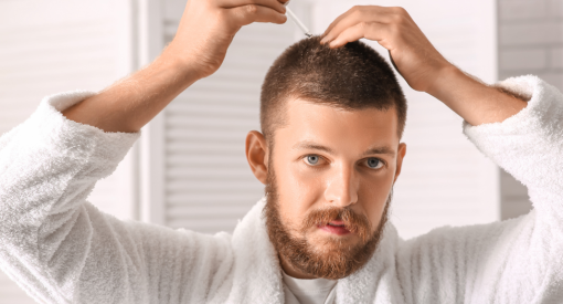 homme qui a fait une greffe de cheveux