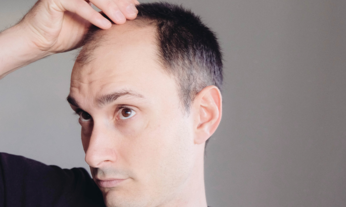 homme qui observe sa perte de cheveux sur les golfes