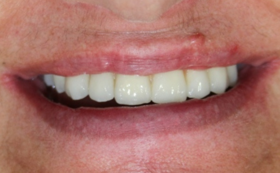 sourire apres soins dentaires maube