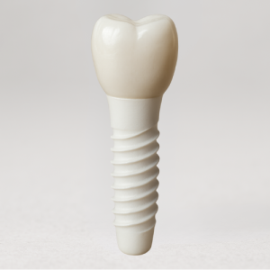 image d'un implant dentaire en zircone et sa couronne
