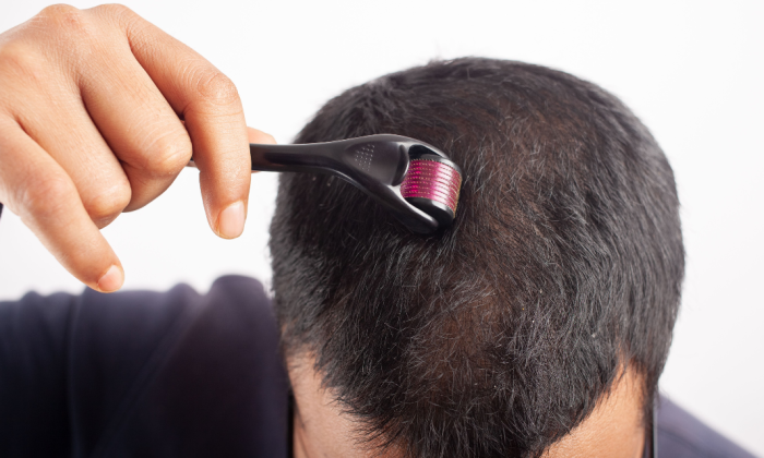 homme qui utilise un dermaroller pour cheveux