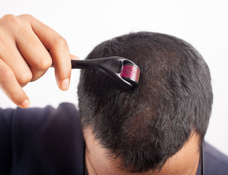 homme qui utilise un dermaroller pour cheveux
