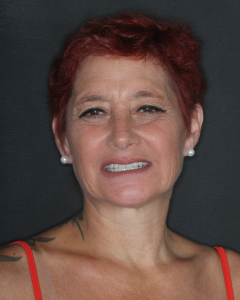 paola patiente soins dentaires