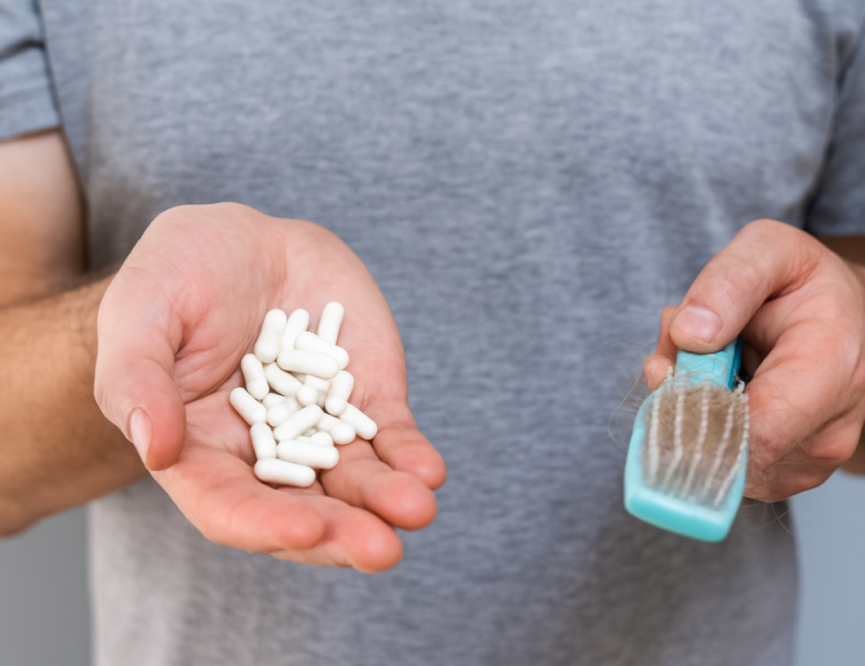 perte de cheveux dans la brosse et comprimés finastéride