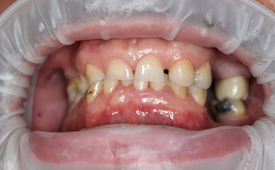 photo-avant-soins-dentaires