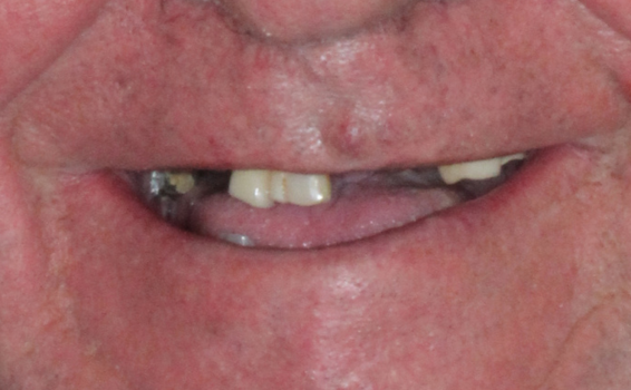 sourire de jean-paul avant