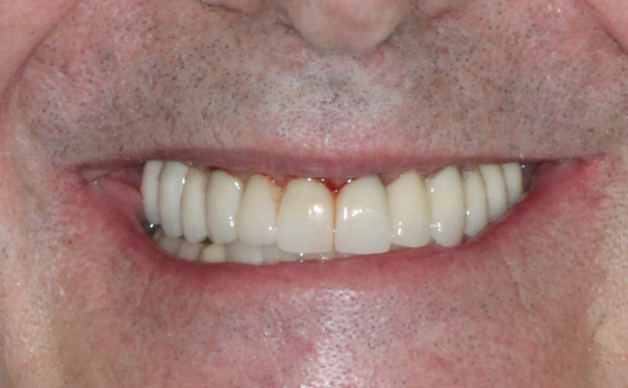 sourire de eric avant