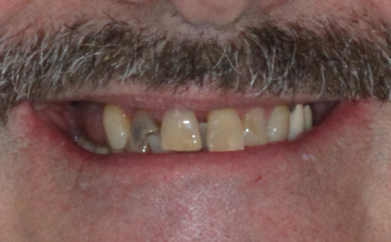 sourire de eric avant