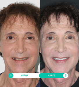 rolland soins dentaires avant apres