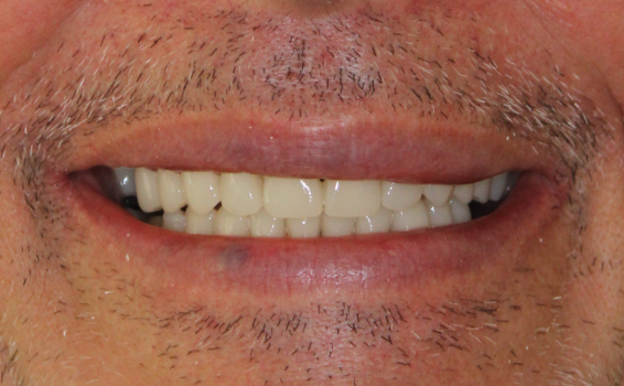 sourire apres les soins dentaires