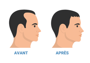 avant apres traitements medicaux