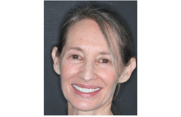 sourire-apres-soins-sylvia