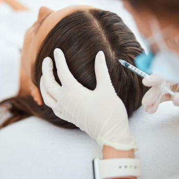 traitement cuir chevelu femme