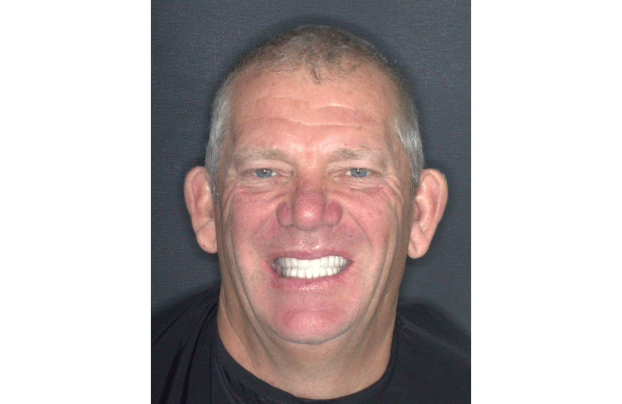 patient clinique espagne