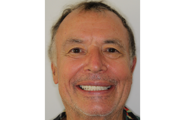 sourire-apres-soins-jean-noel