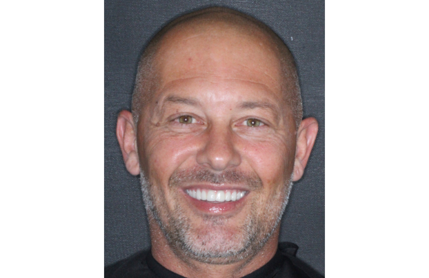 parodontite patient clinique