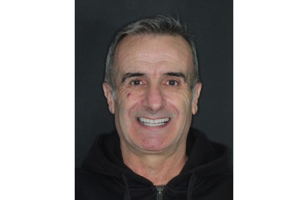 patient clinique barcelone