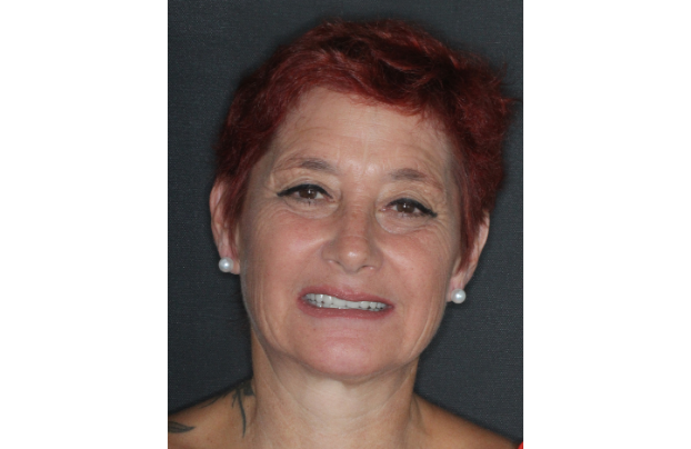 patient clinique espagne