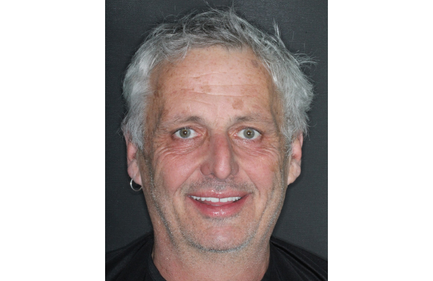 patient clinique barcelone