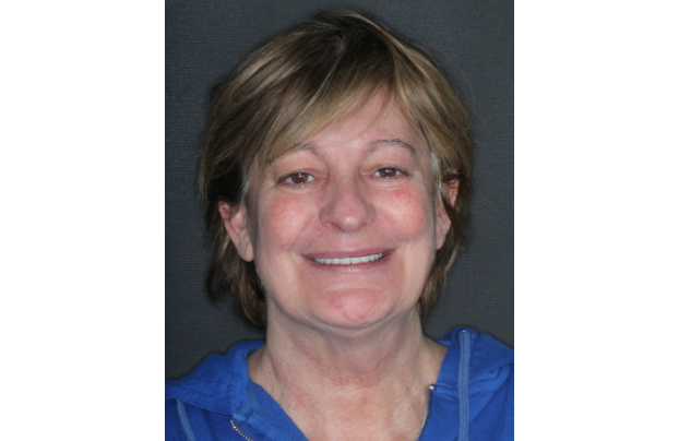 sourire-apres-soins-sonia